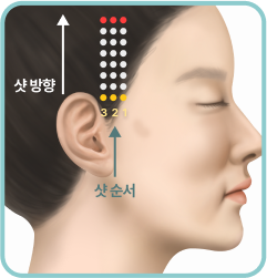 샷 방향, 샷 순서