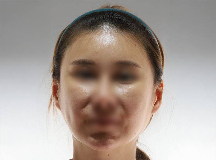 비표사진
