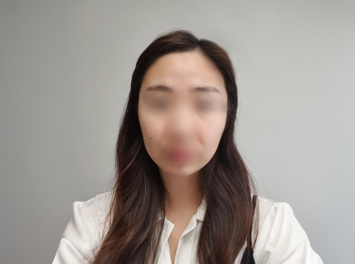 비포사진